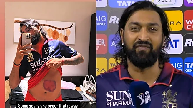 Krunal Pandya shows off his battle scar after match-winning knock in RCB vs MI