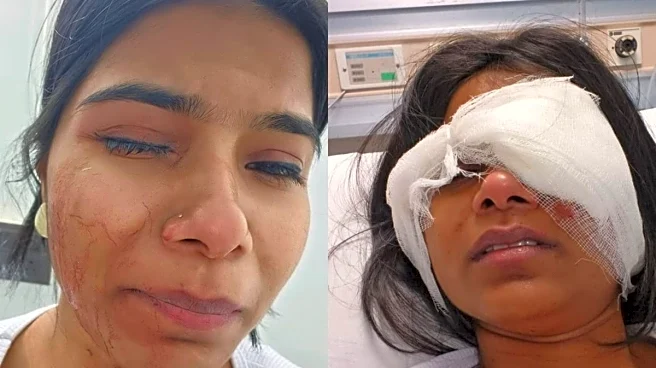 Pune Road Rage: Woman Suffers Serious Eye Injury After Bike-Borne Men Chase Car, Smash Windows