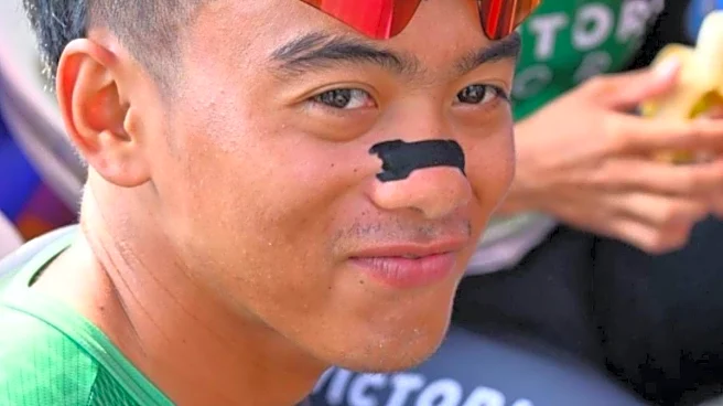 Pune Grand Tour Sees Cyclists Wear Black Nose Strip: What Is It? Is It A Safety Gear? Where Can You Buy It?
