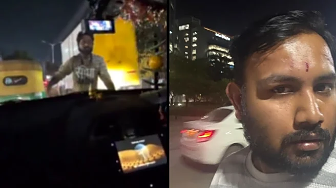 'I'm Going To Leave Bengaluru': Man Alleges Assault By Auto Drivers Over Minor Dispute