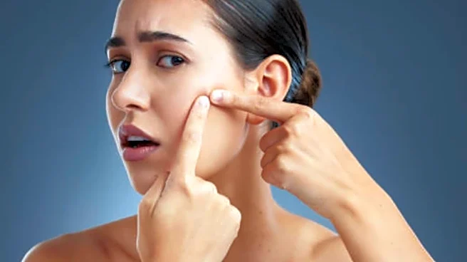 Summer Acne Surge: How Heat, Sweat And Humidity Are Worsening Breakouts