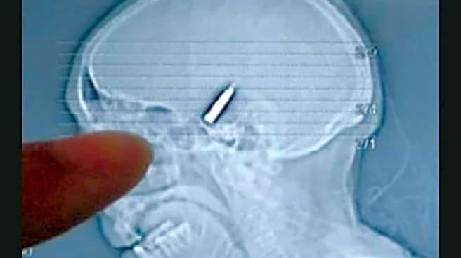 She Lived With A Bullet In Her Brain For Years And Only Found Out By Accident