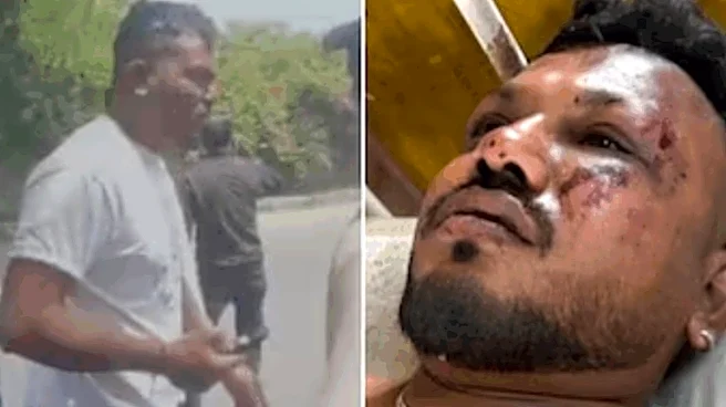‘Challenges Continue Behind Closed Doors’: Air India Plane Crash's Lone Survivor Still Coping With Trauma