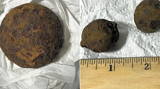 Airport Security Finds 5 Cannonballs In Luggage In Alabama; Internet Says 'Man Has Hobbies'