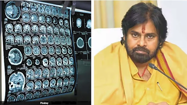 Woman watches Pawan Kalyan's 'OG' during brain surgery