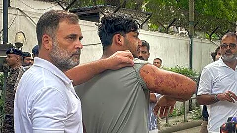 Supreme Court orders care after NEET pellet injuries in Delhi