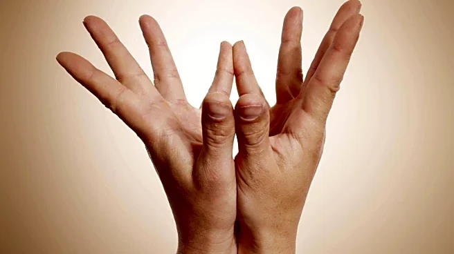 5 hand mudras that profoundly affect your well-being