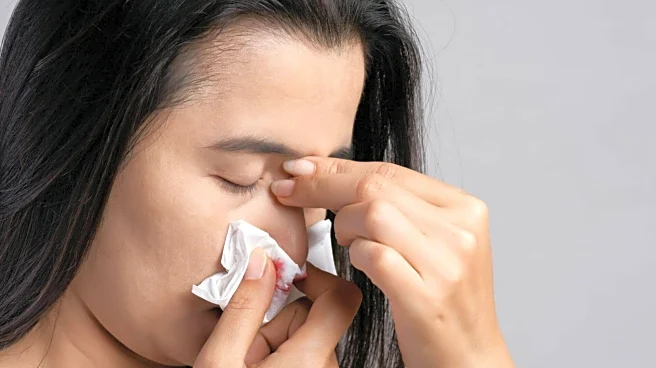 Nose bleeding? Fix it with these home remedies