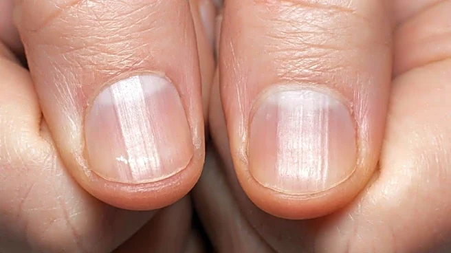 Fix fingernail ridges with these kitchen ingredients