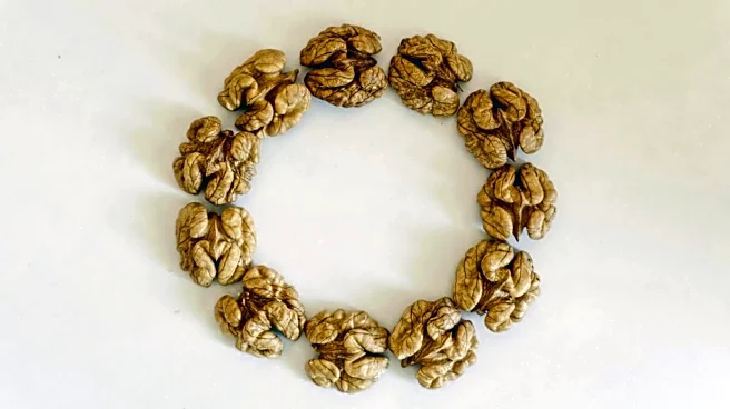 The healthiest raw nuts to add to your diet