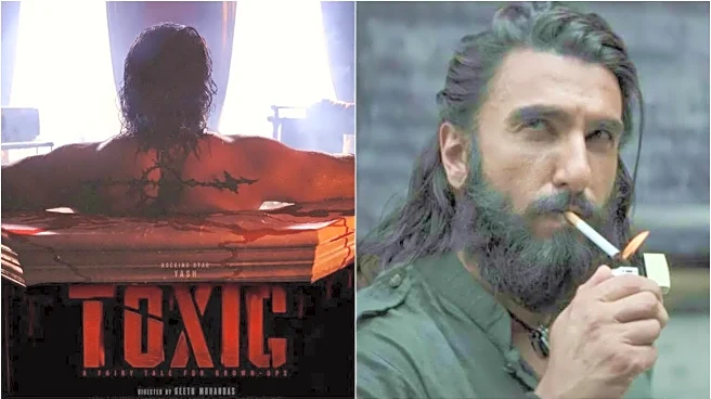 Toxic Vs Dhurandhar 2: Yash Reminds His Film Is '100 Days' Away; Fans Demand Makers To Avoid 'Big Clash' Of 2026