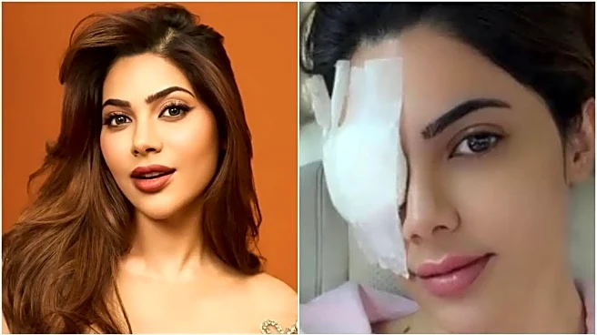 Is Nikki Tamboli Fit For The 50 After Eye Surgery? Contestant Shares Health Update – EXCLUSIVE
