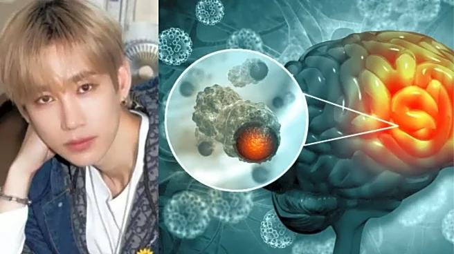 CLASSMATE’s Heo Seong Jeong Reveals Brain Cancer Diagnosis: Early Warning Signs to Know