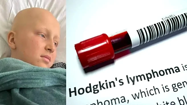 Teenager Told Neck Lump Was Tonsillitis, Later Diagnosed with Stage 4 Hodgkin Lymphoma Cancer
