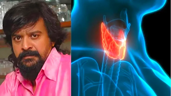 KGF Actor Harish Rai’s Death Raises Awareness About Thyroid Cancer; Symptoms and Causes Explained