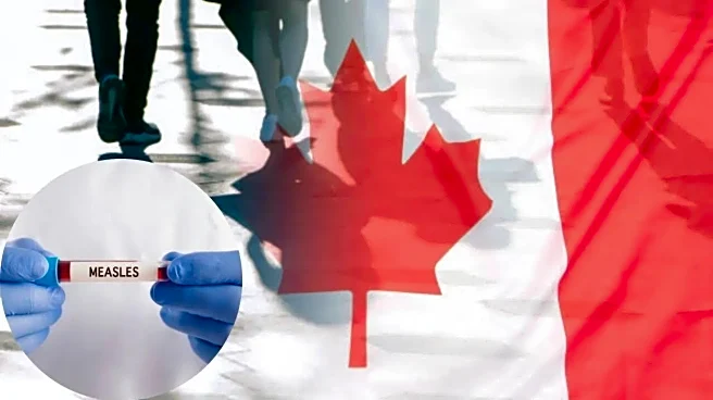 Canada Loses Measles Elimination Status After Ongoing Outbreaks