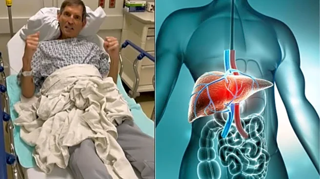 Bernie Kosar Gets Liver Transplant After Extended Wait: What the Procedure Involves
