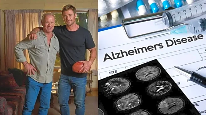 `Thor' Chris Hemsworth Reveals Father’s Alzheimer’s Diagnosis: Can Reminiscence Therapy Help Seniors?