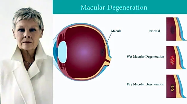 Judi Dench Says She Cannot Recognise Faces Due to Worsening Eye Condition: What Is Macular Degeneration?