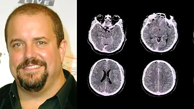 Mavericks Frontman Raúl Malo Dies of Rare Leptomeningeal Cancer; Know the Early Warning Signs