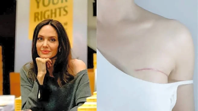 Angelina Jolie Opens Up About Showing Her Mastectomy Scars: What the Life-Saving Procedure Is and Why It’s Done