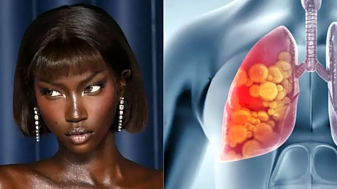 Supermodel Anok Yai Reveals Hidden Congenital Defect That Was Destroying Her Lungs - Left Her Gasping for Breath