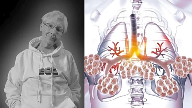 Beloved Epic Gamer Grandma Agnes Dies After Long COPD Battle: Early Warning Signs to Know