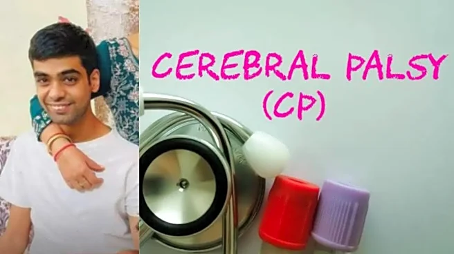 IIT Graduate with Cerebral Palsy Clears UPSC in First Attempt; Understanding the Condition and Its Impact on Daily Living