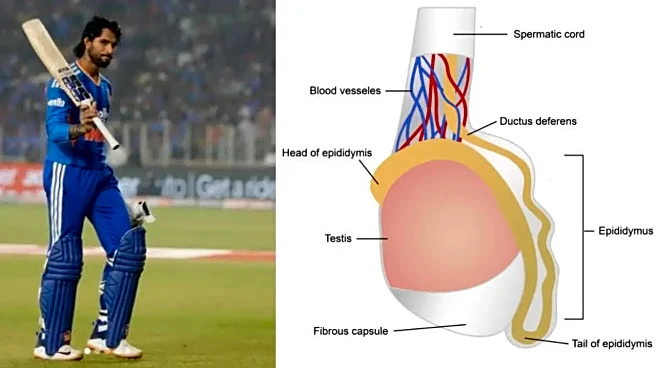 Testicular Torsion Explained: Why Tilak Varma Had an Emergency Surgery and Its Health Risks
