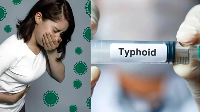 Got Typhoid Even After Drinking Clean Water? Hidden Causes Doctors Warn About