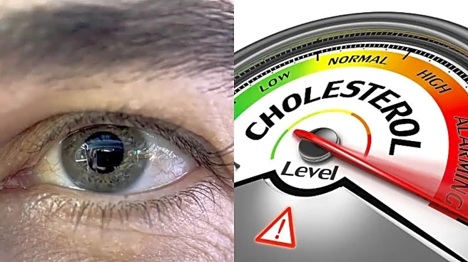 High Cholesterol Warning: This Colourful Facial Symptom Should Not Be Ignored