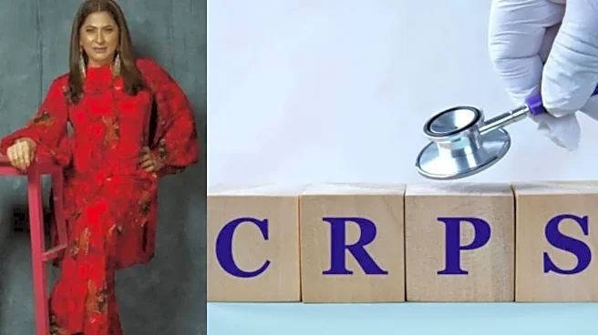 What Is Complex Regional Pain Syndrome, a Painful Condition Archana Puran Singh Has Developed on Her Hand