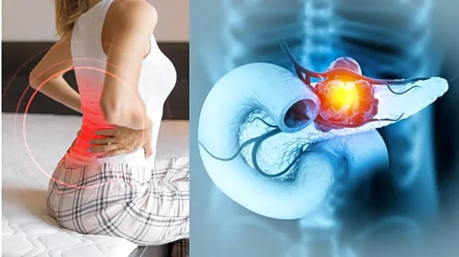 Pancreatic Cancer Warning: A Painful Back Symptom That May Signal a Spreading Tumour