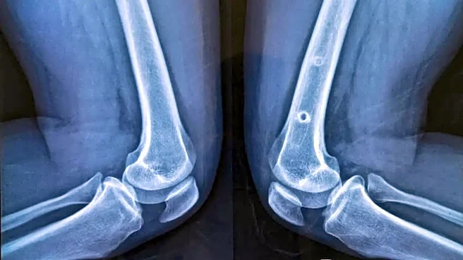 Knees Bending Too Easily? Unexpected Flexibility May Be an Early Sign of Arthritis