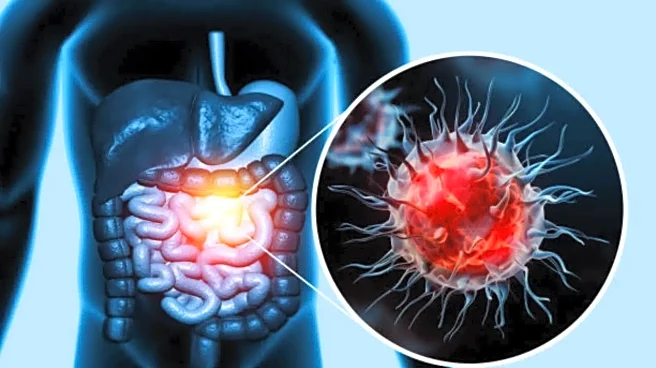 Colon Cancer is Now the Leading Cause of Cancer Death in People Under 50