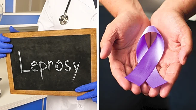 Understanding Leprosy: Early Signs, Causes, and Cure