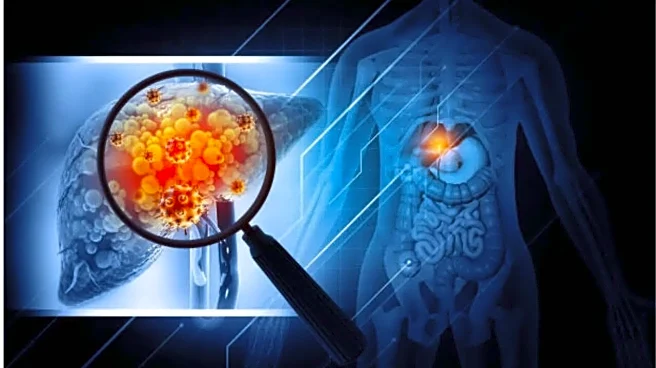 From Fatty Liver to Liver Cancer: How Doctors Treated a High-Risk Senior Without Surgery