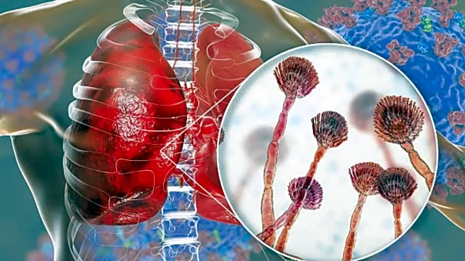 The Silent Fungal Lung Infection Most People Have Never Heard Of: Aspergillosis