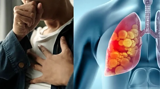 Early Lung Cancer Symptoms Doctors Say People Keep Overlooking