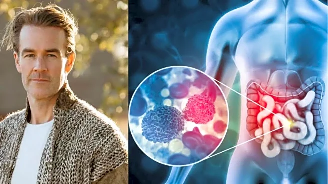 James Van Der Beek's Death: The Early Sign of Colon Cancer That Dawson’s Creek Star Overlooked