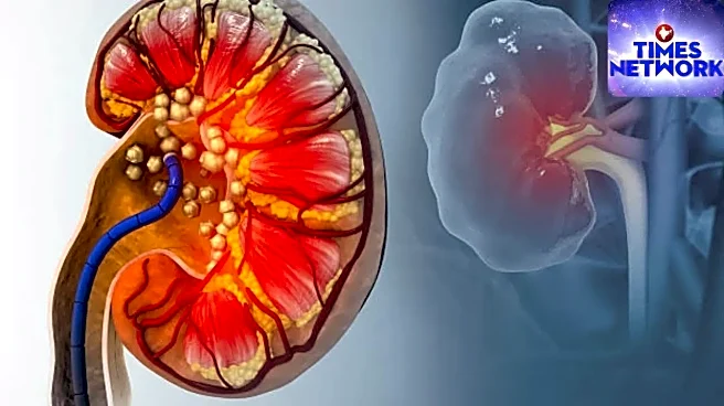 Why Kidney Stones Spike in Summer: Hidden Risks Explained