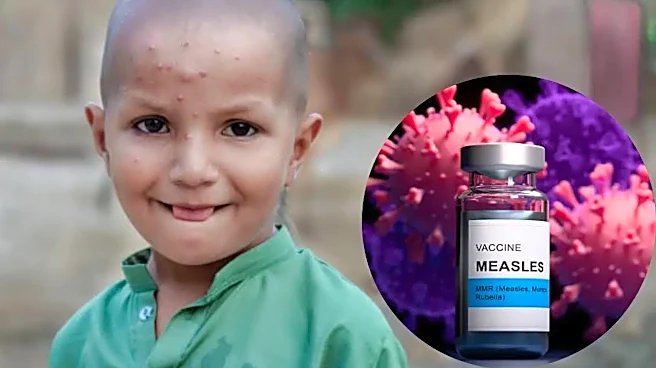 Measles Outbreak in Bangladesh Kills 100 Children: Is India at Risk?