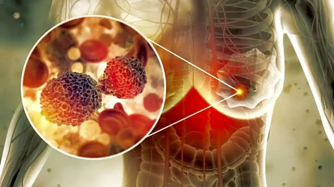 Chennai Sees Alarming Rise in Breast Cancer Cases In a Decade; Doctors Stress Early Detection