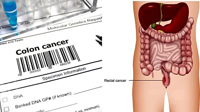 US Rectal Cancer Crisis: Deaths Rising Among Millennials, Doctors Sound Alarm
