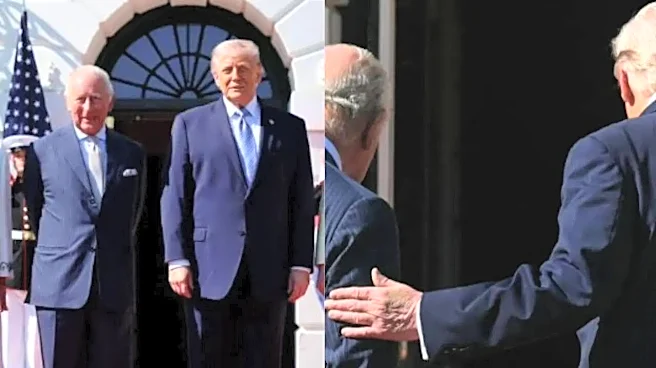 Donald Trump’s Photos With King Charles Spark Renewed Concerns Over Hand Discolouration