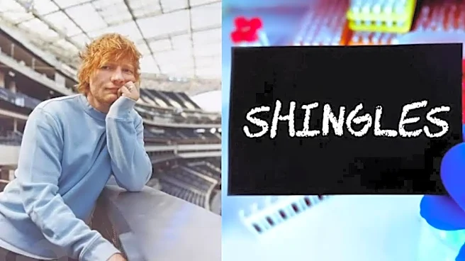 Ed Sheeran Reveals Painful Shingles Battle: A Wake-up Call on Hidden Risks