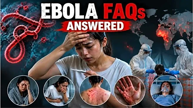 Ebola FAQs Everyone Is Searching Right Now - From Symptoms to Survival Chances