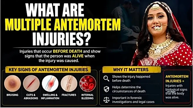 Twisha Sharma Death: What Are ‘Multiple Antemortem Injuries’ Found Before Her Alleged Suicide?