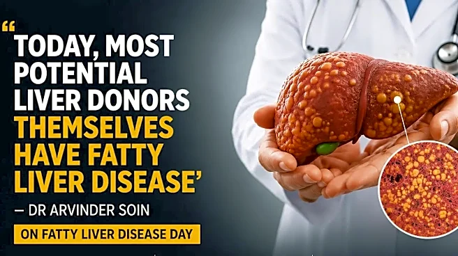 'Today Most Potential Liver Donors Themselves Have Fatty Liver Disease': Senior Liver Doctor Dr Arvinder Soin