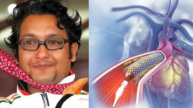 Jaspal Rana Death: Can a Heart Stent Fail? What Patients Need to Know